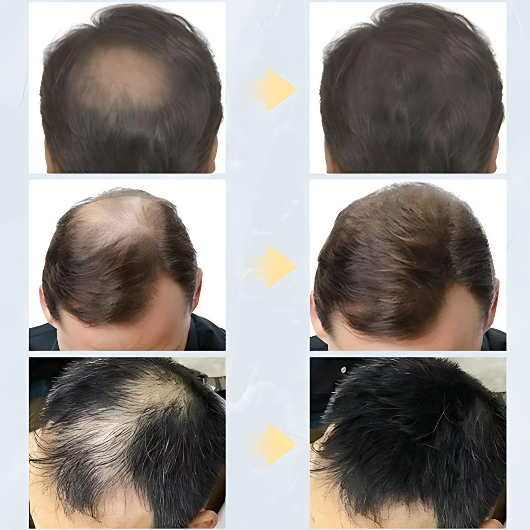FIBRA CAPILAR TOPPIK - VOLVE A CONFIAR EN TU PELO