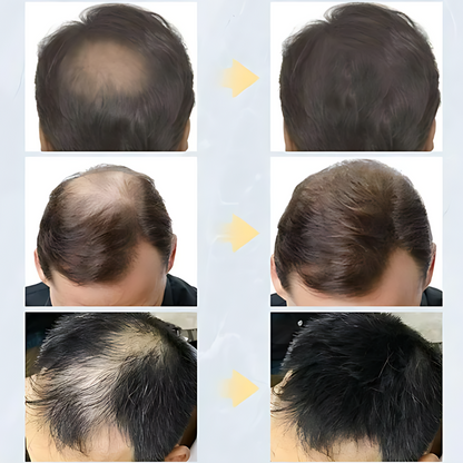 FIBRA CAPILAR TOPPIK - VOLVE A CONFIAR EN TU PELO
