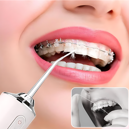 🦷 Irrigador Bucal Premium – Encías sanas y limpieza profunda en casa