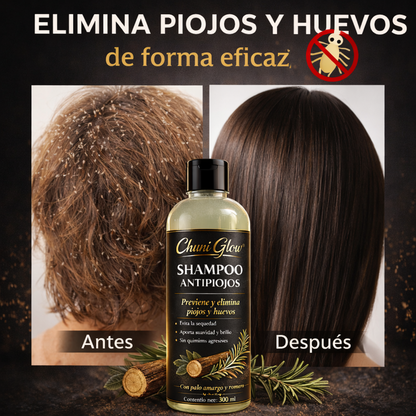 Shampoo y Acondicionado Anti piojos, la solucion que estabas buscando...